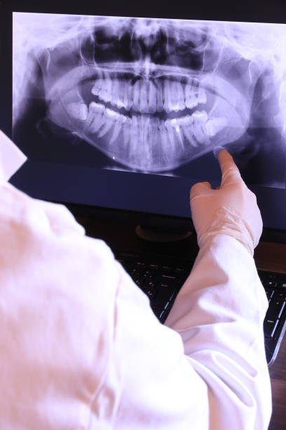 Best Emergency Treatment for Dental Infections or Abscesses in Hewitt, TX