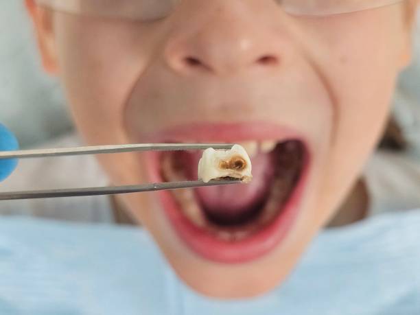 Best Same-Day Emergency Dental Services in Hewitt, TX